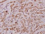 PLA2G4A Antibody in Immunohistochemistry (Paraffin) (IHC (P))