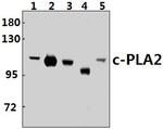 PLA2G4A Antibody in Western Blot (WB)