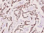 UBA2 Antibody in Immunohistochemistry (Paraffin) (IHC (P))