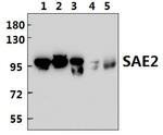 UBA2 Antibody in Western Blot (WB)