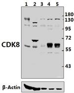 CDK8 Antibody in Western Blot (WB)