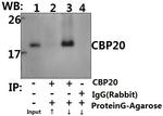 NCBP2 Antibody in Immunoprecipitation (IP)