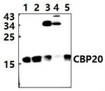 NCBP2 Antibody in Western Blot (WB)