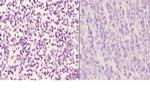 LMO4 Antibody in Immunohistochemistry (Paraffin) (IHC (P))