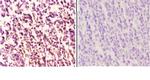 MEF2B Antibody in Immunohistochemistry (Paraffin) (IHC (P))