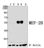 MEF2B Antibody in Western Blot (WB)