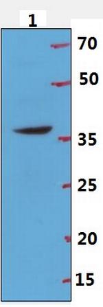 p39 Antibody in Western Blot (WB)