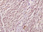 GK2 Antibody in Immunohistochemistry (Paraffin) (IHC (P))