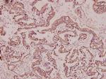 BRMS1 Antibody in Immunohistochemistry (Paraffin) (IHC (P))