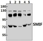 DCP1A Antibody in Western Blot (WB)