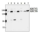 Adenylate Cyclase 5/6 Antibody in Western Blot (WB)