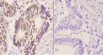 hnRNP C1/C2 Antibody in Immunohistochemistry (Paraffin) (IHC (P))