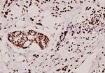 hnRNP A1 Antibody in Immunohistochemistry (Paraffin) (IHC (P))