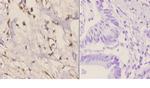 RAD51C Antibody in Immunohistochemistry (Paraffin) (IHC (P))