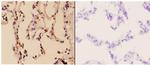 RAD51B Antibody in Immunohistochemistry (Paraffin) (IHC (P))