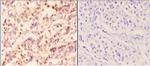 RAD51B Antibody in Immunohistochemistry (Paraffin) (IHC (P))