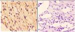 RAD51B Antibody in Immunohistochemistry (Paraffin) (IHC (P))