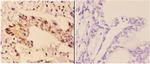 RAD51B Antibody in Immunohistochemistry (Paraffin) (IHC (P))