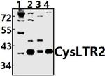 CYSLTR2 Antibody in Western Blot (WB)