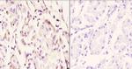 IP6K2 Antibody in Immunohistochemistry (Paraffin) (IHC (P))