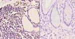 IP6K2 Antibody in Immunohistochemistry (Paraffin) (IHC (P))