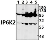 IP6K2 Antibody in Western Blot (WB)