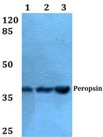 RRH Antibody in Western Blot (WB)