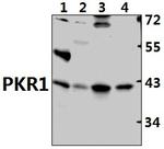 Prokineticin Receptor 1 Antibody in Western Blot (WB)