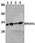 RPS4Y1 Antibody in Western Blot (WB)