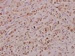 KDELR2 Antibody in Immunohistochemistry (Paraffin) (IHC (P))