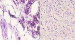 OXER1 Antibody in Immunohistochemistry (Paraffin) (IHC (P))