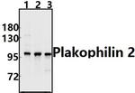 PKP2 Antibody in Western Blot (WB)