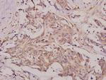 BMP-6 Antibody in Immunohistochemistry (Paraffin) (IHC (P))