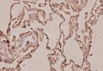 S100A10 Antibody in Immunohistochemistry (Paraffin) (IHC (P))