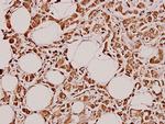 GUCY1A3 Antibody in Immunohistochemistry (Paraffin) (IHC (P))