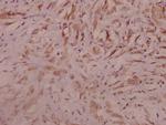 SEMA3A Antibody in Immunohistochemistry (Paraffin) (IHC (P))