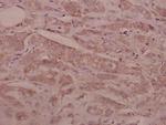 SEMA3C Antibody in Immunohistochemistry (Paraffin) (IHC (P))