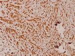 PEX14 Antibody in Immunohistochemistry (Paraffin) (IHC (P))