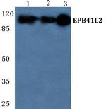 EPB41L2 Antibody in Western Blot (WB)