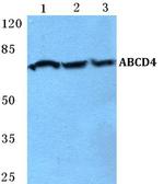 ABCD4 Antibody in Western Blot (WB)