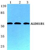 ALDH1B1 Antibody in Western Blot (WB)