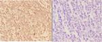 Arp3 Antibody in Immunohistochemistry (Paraffin) (IHC (P))