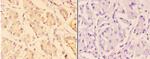 Arp3 Antibody in Immunohistochemistry (Paraffin) (IHC (P))