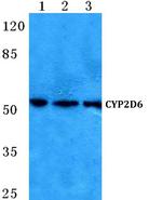 CYP2D6 Antibody in Western Blot (WB)