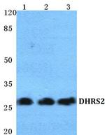 DHRS2 Antibody in Western Blot (WB)