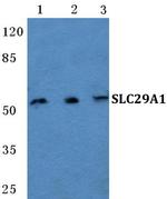 ENT1 Antibody in Western Blot (WB)