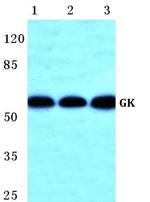 Glycerol kinase Antibody in Western Blot (WB)