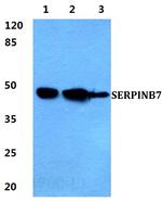 SERPINB7 Antibody in Western Blot (WB)