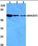 GEF5 Antibody in Western Blot (WB)