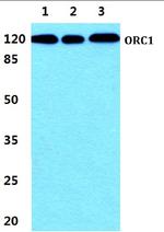 ORC1 Antibody in Western Blot (WB)